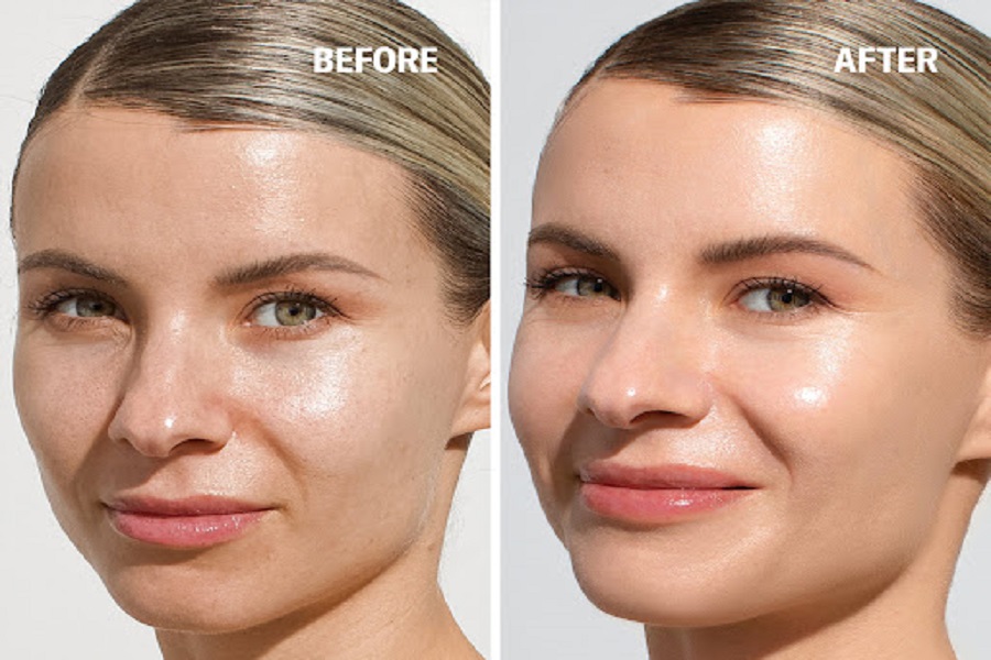 قبل و بعد استفاده از ضد افتاب اکسیس وای