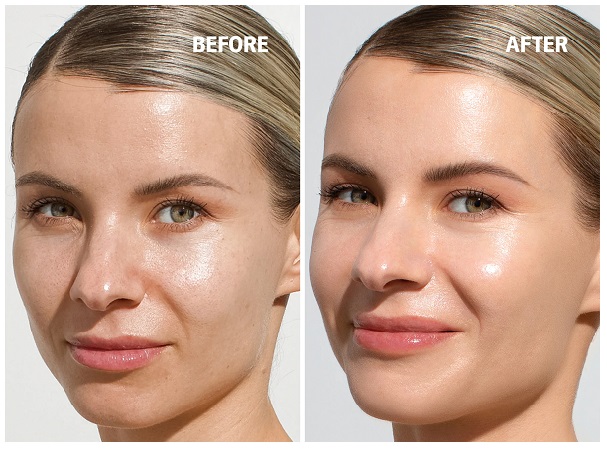 قبل و بعد ضد آفتاب کلینیک سولار اسمارت SPF 50