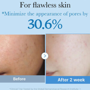 قبل-و-بعد-تونر-منافذ-مدی-کیوب